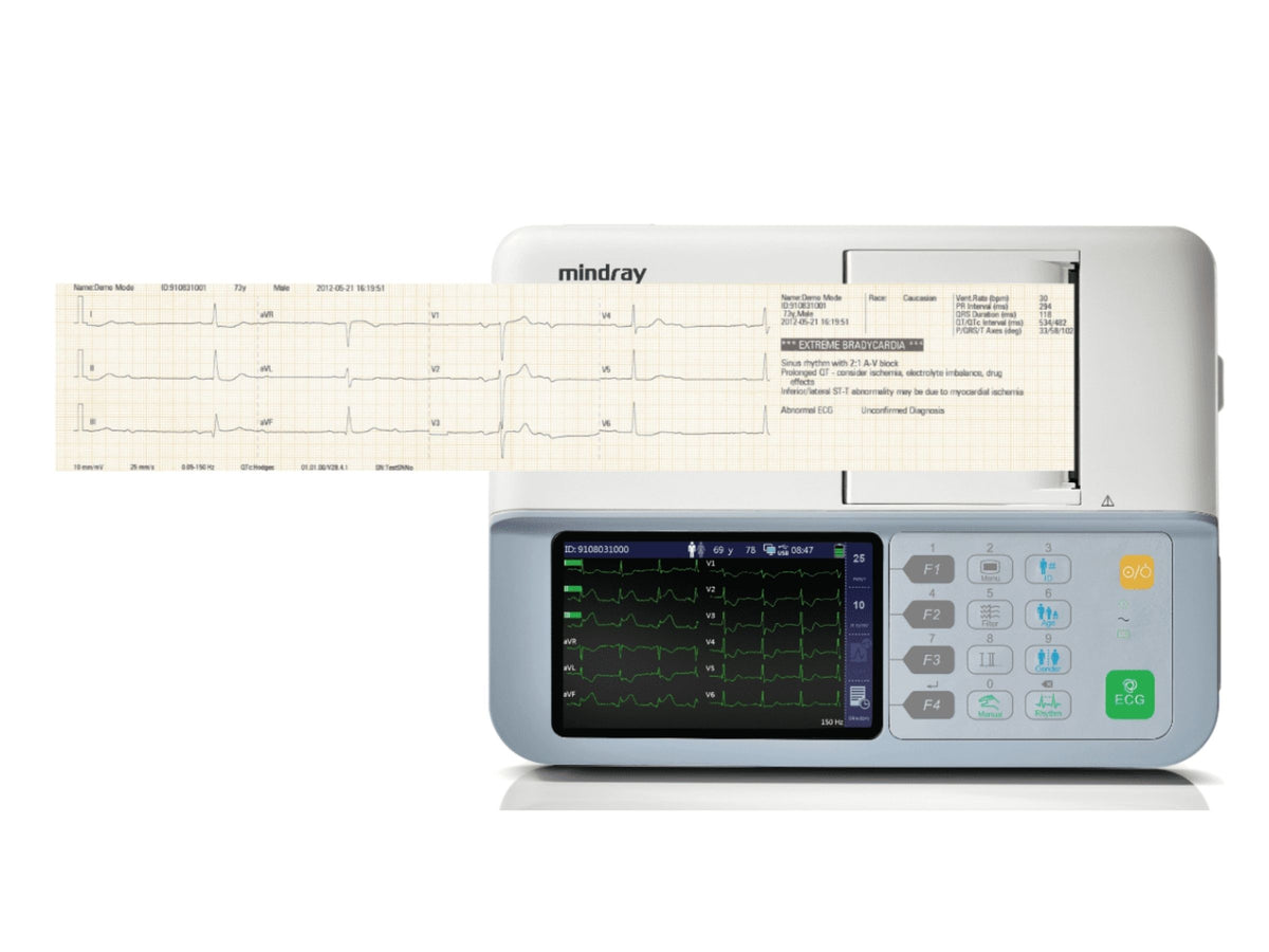 Mindray Animal R3 Vet ECG