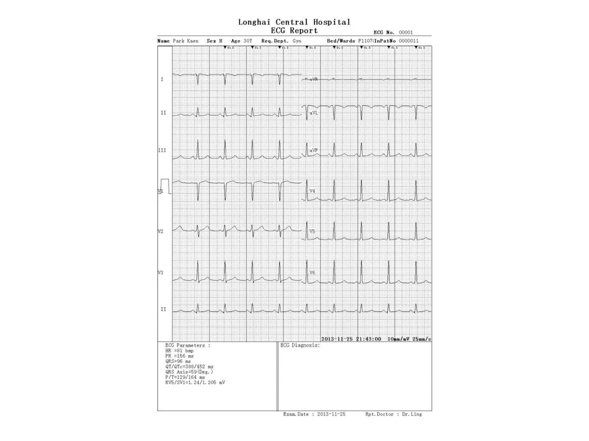 Three Channel Veterinary ECG