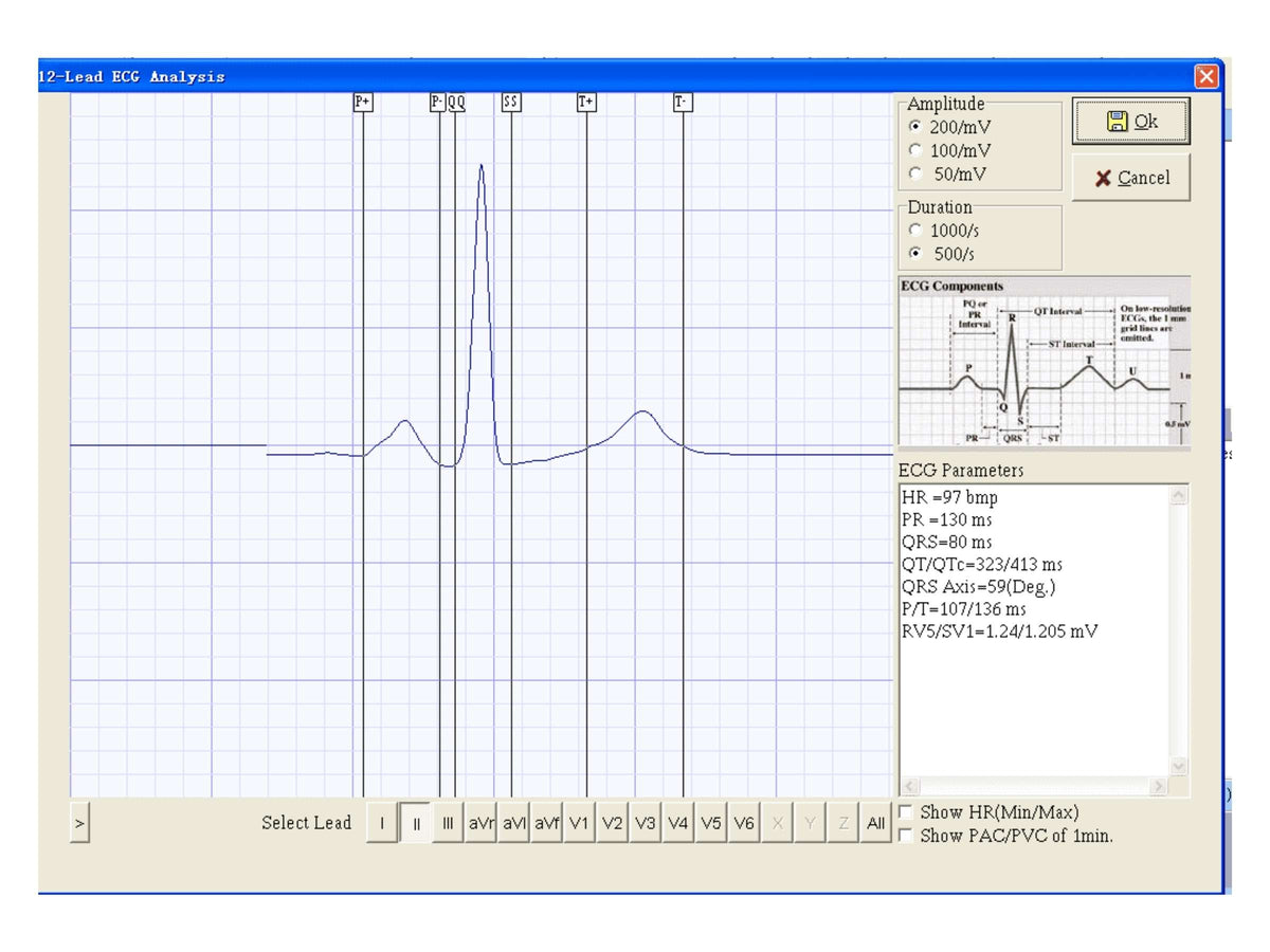 Three Channel Veterinary ECG