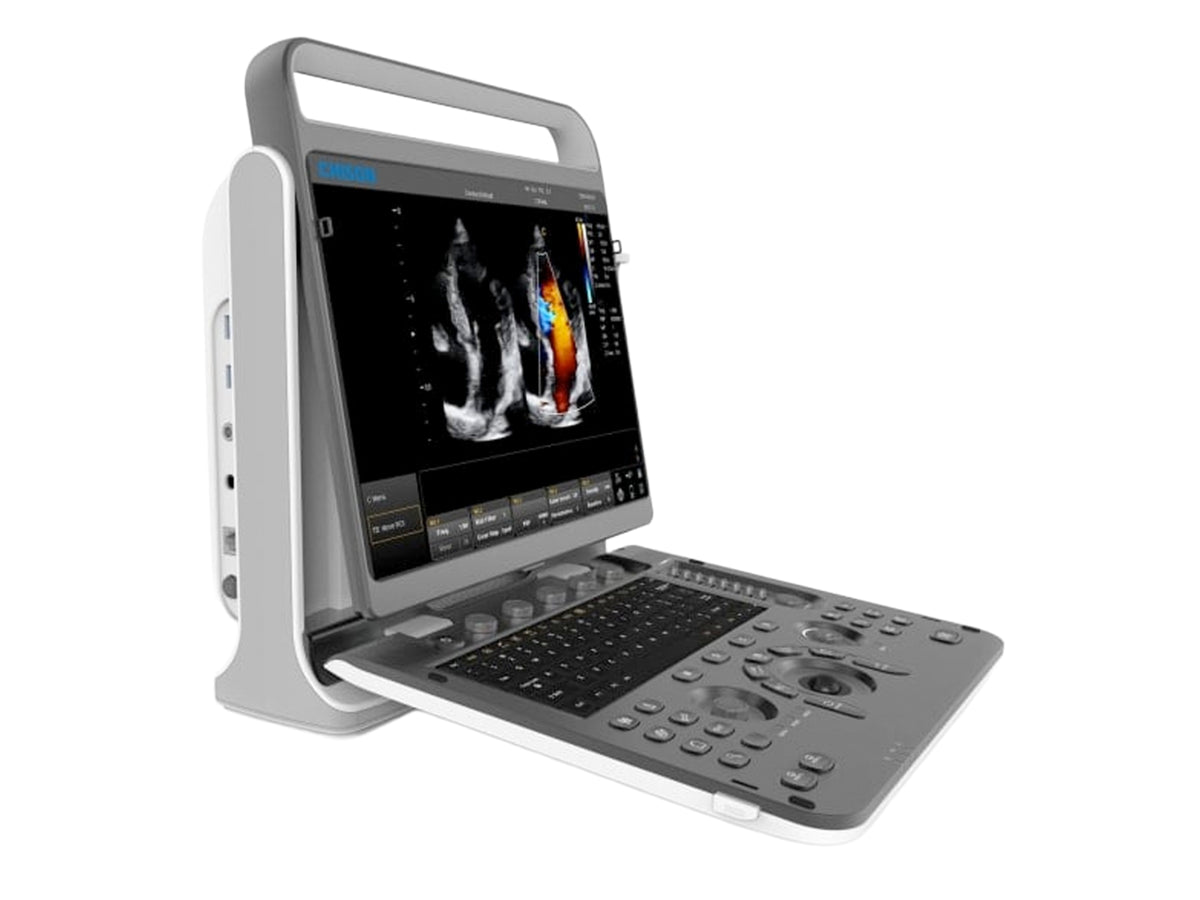 Chison EBit60 Medical Ultrasound
