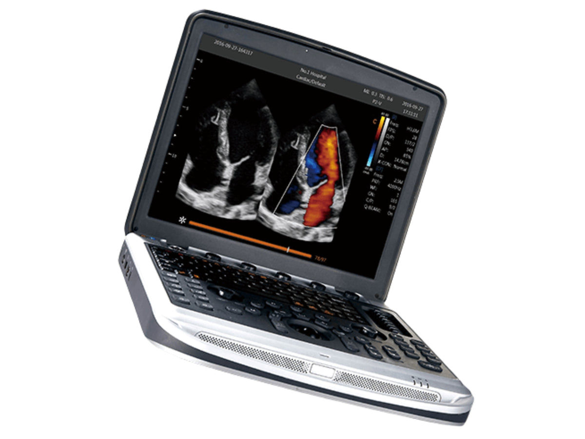 Chison SonoBook Vet Ultrasound