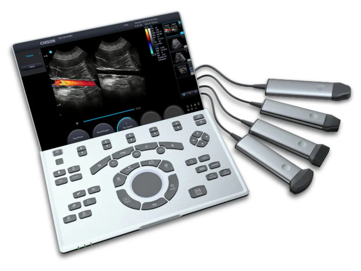 Chison SonoAir Vet Ultrasound