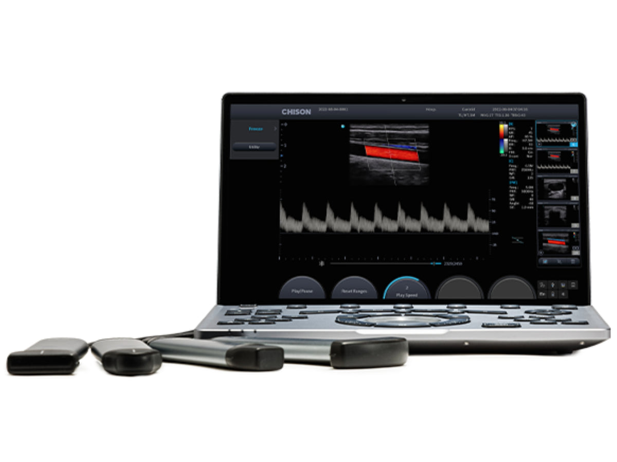 Chison SonoAir Vet Ultrasound
