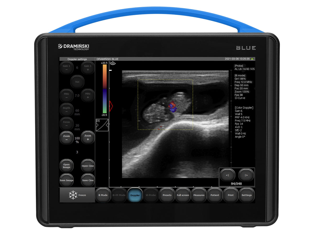 Draminski BLUE Ultrasound Scanner