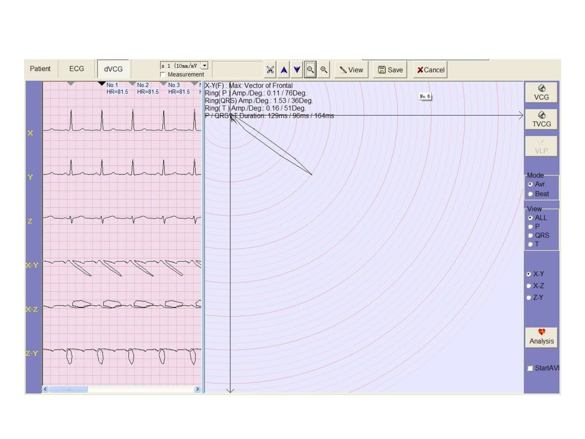 Three Channel Veterinary ECG