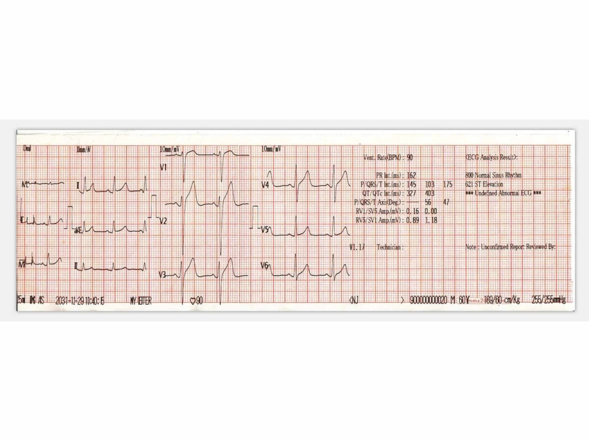 Three Channel Veterinary ECG