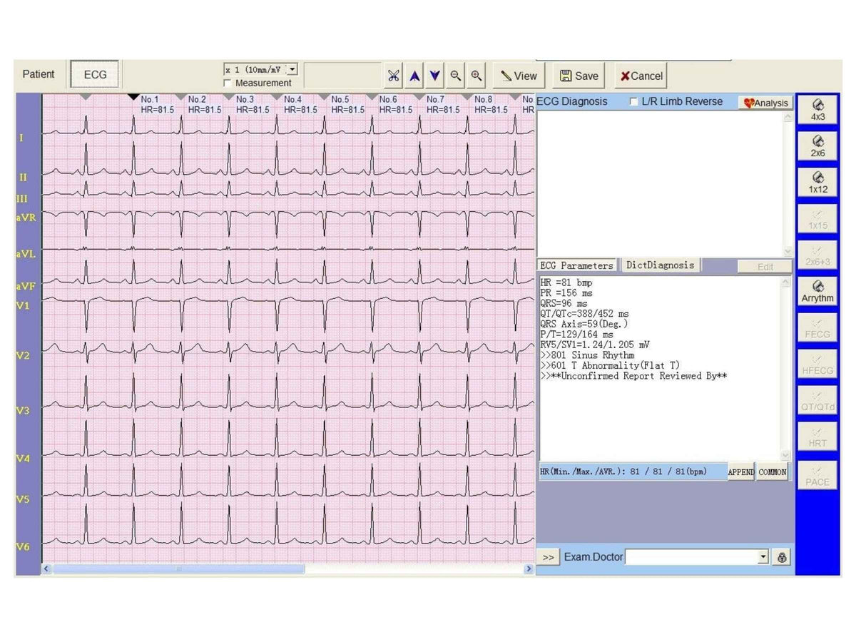 Three Channel Veterinary ECG