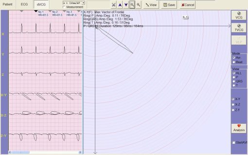 Electrocardiograph Vet ECG - 3R ECG Software 4