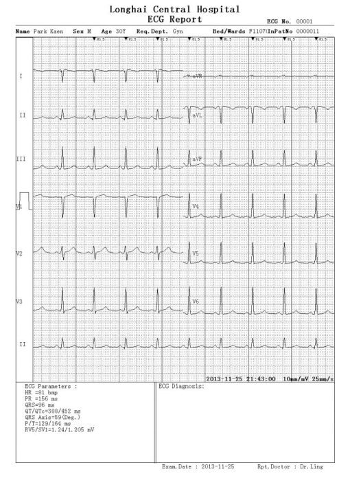 Electrocardiograph Vet ECG - ECG 1