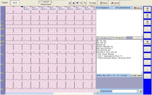 Electrocardiograph Vet ECG - ECG 2