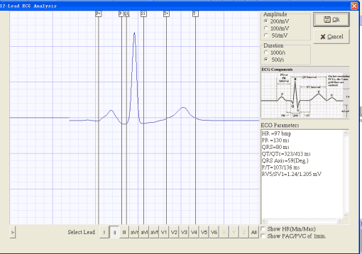 Electrocardiograph Vet ECG - ECG 2