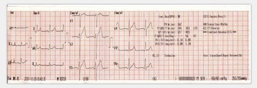 Electrocardiograph Vet ECG - Image 2