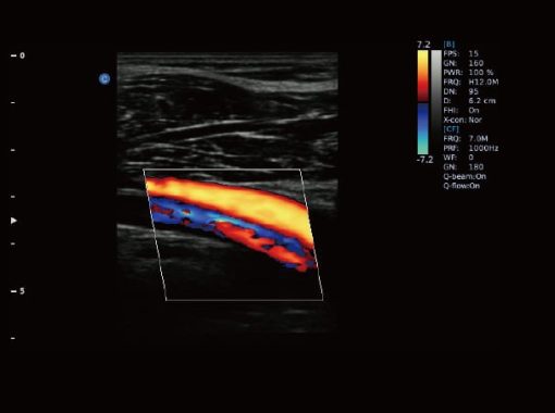 - Popliteal Artery and Vein Ebit50 Medical