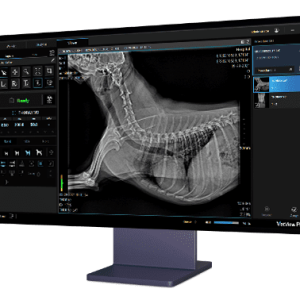 Digital X-Ray Systems