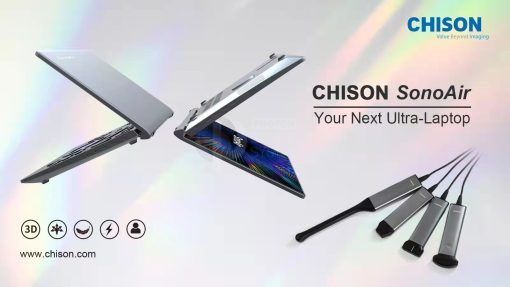 Chison SonoAir - Leaflet 1