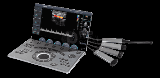 Chison SonoAir - SonoAir2